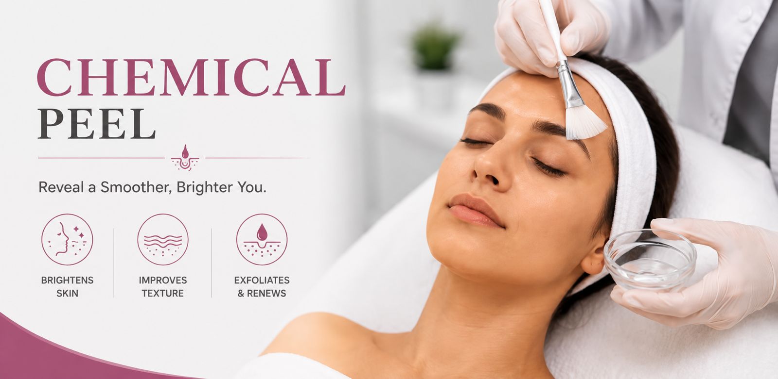 Chemical Peel