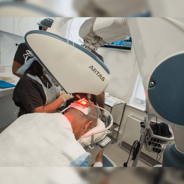 Robotic Hair Transplant by Dr. Rashmi Aderao