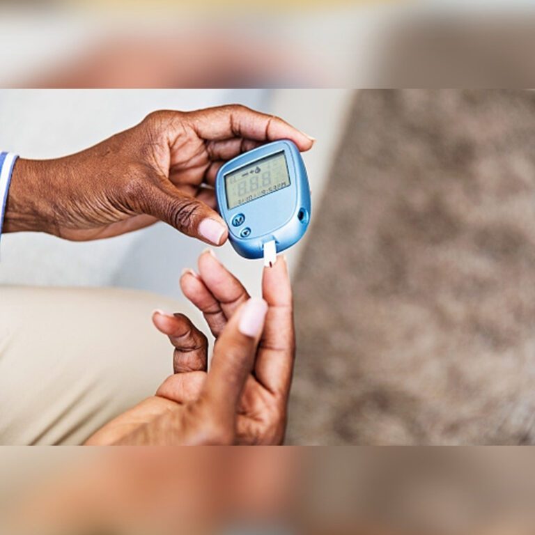 THE TOP 5 REASON WHY DOES DIABETES MAKE YOU BALD