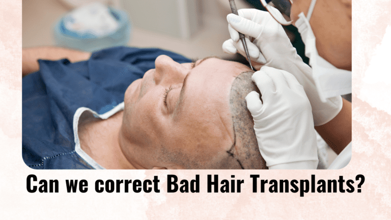 Can we correct Bad Hair Transplants?