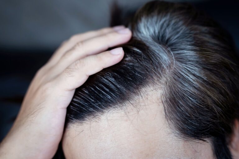 GreyHair