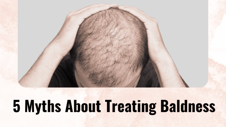 5 Myths About Treating Baldness