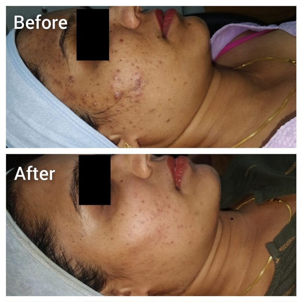 trusted Skin specialist Kothrud
