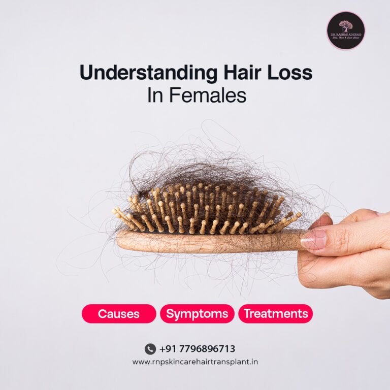 Understanding Hair Loss in Females: Causes, Symptoms, and Solutions