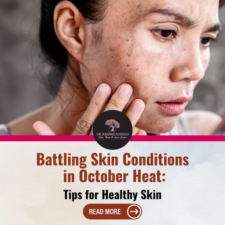 Battling Skin Conditions in October Heat: Tips for Healthy Skin