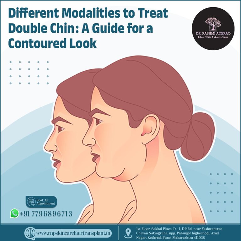 Different Modalities to Treat Double Chin: A Guide for a Contoured Look