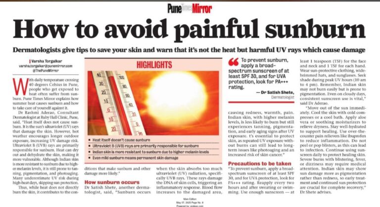 How To Avoid Painful Sunburn