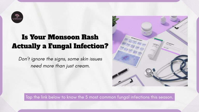 Is That Just a Rash—or a Monsoon Fungal Infection? Know Before It Spreads!