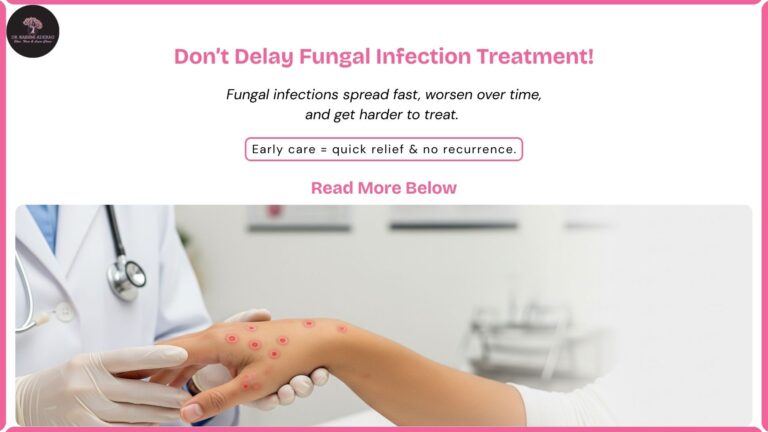 Why You Should Never Delay Treating a Fungal Infection – A Dermatologist’s Advice