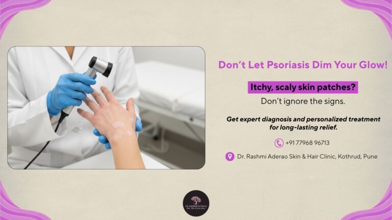 Psoriasis – Everything You Need to Know for Flare-Free Skin