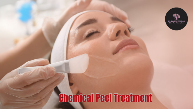 Chemical Peel Treatment