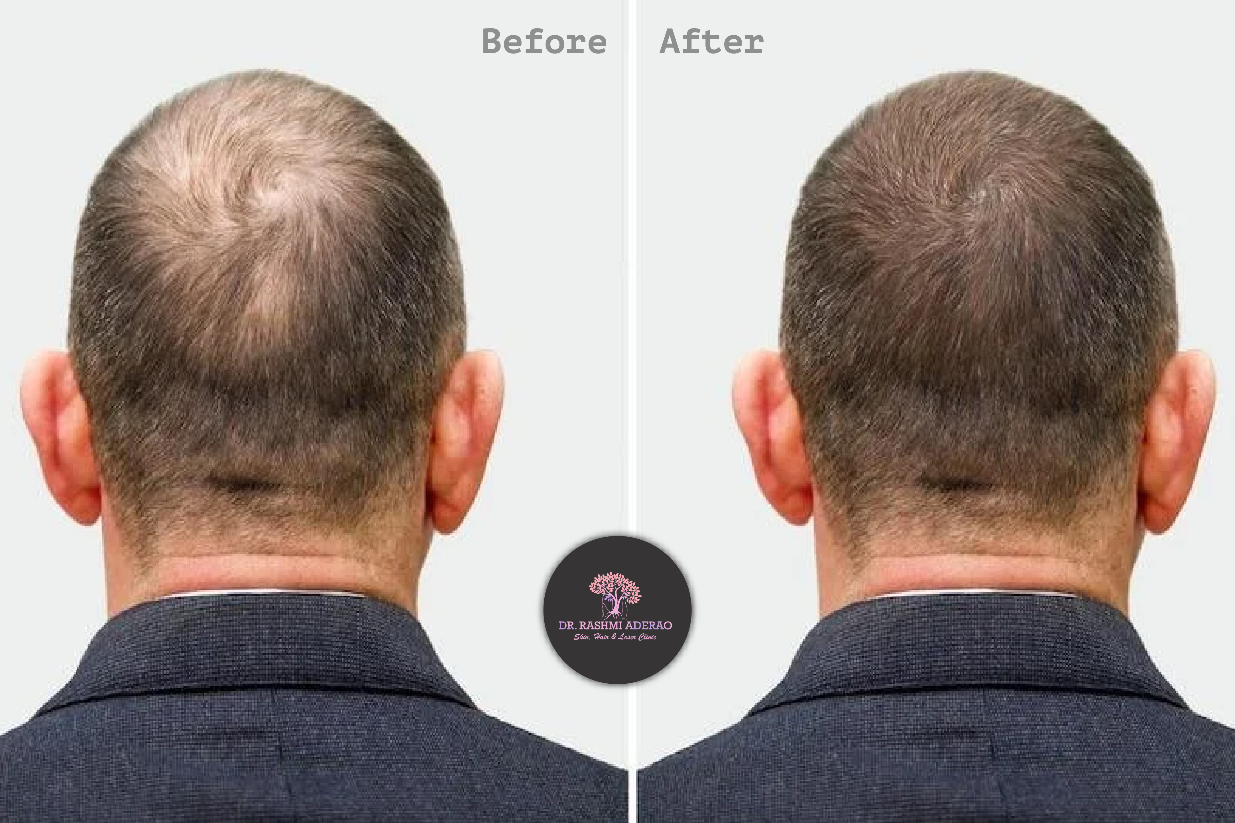 Skin Specialist Kothrud