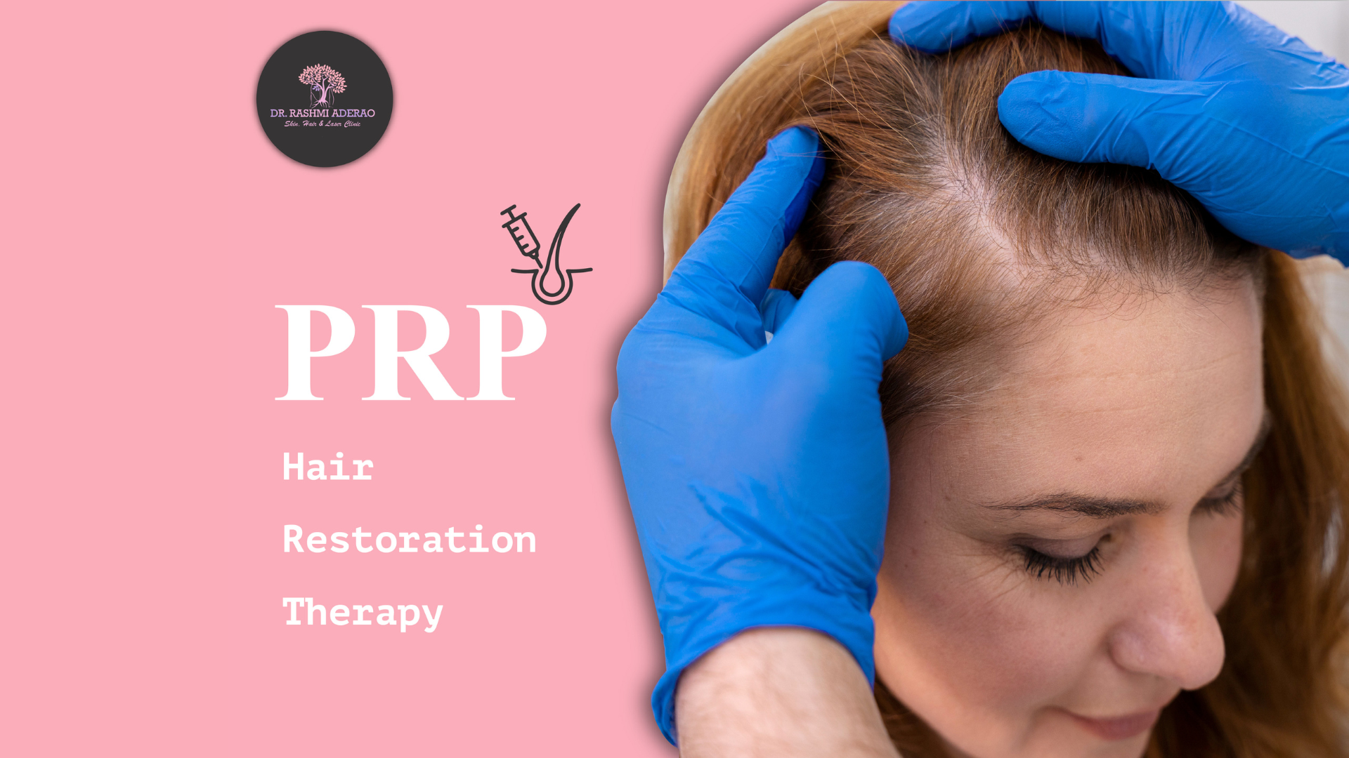 PRP Therapy for Hair in Kothrud Pune