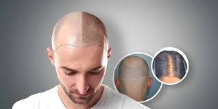 Best Dermatologist in Pune