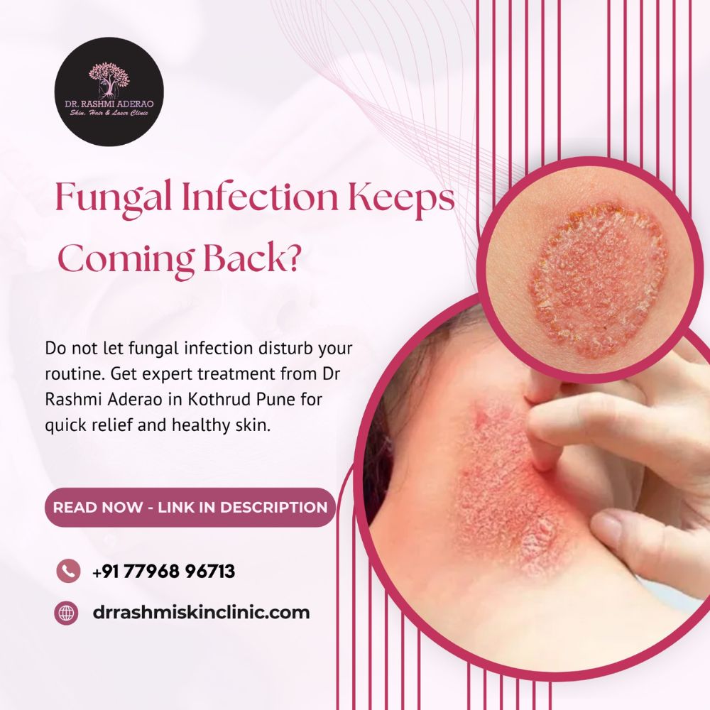 Skin Fungal Infection Treatment in Kothrud Pune