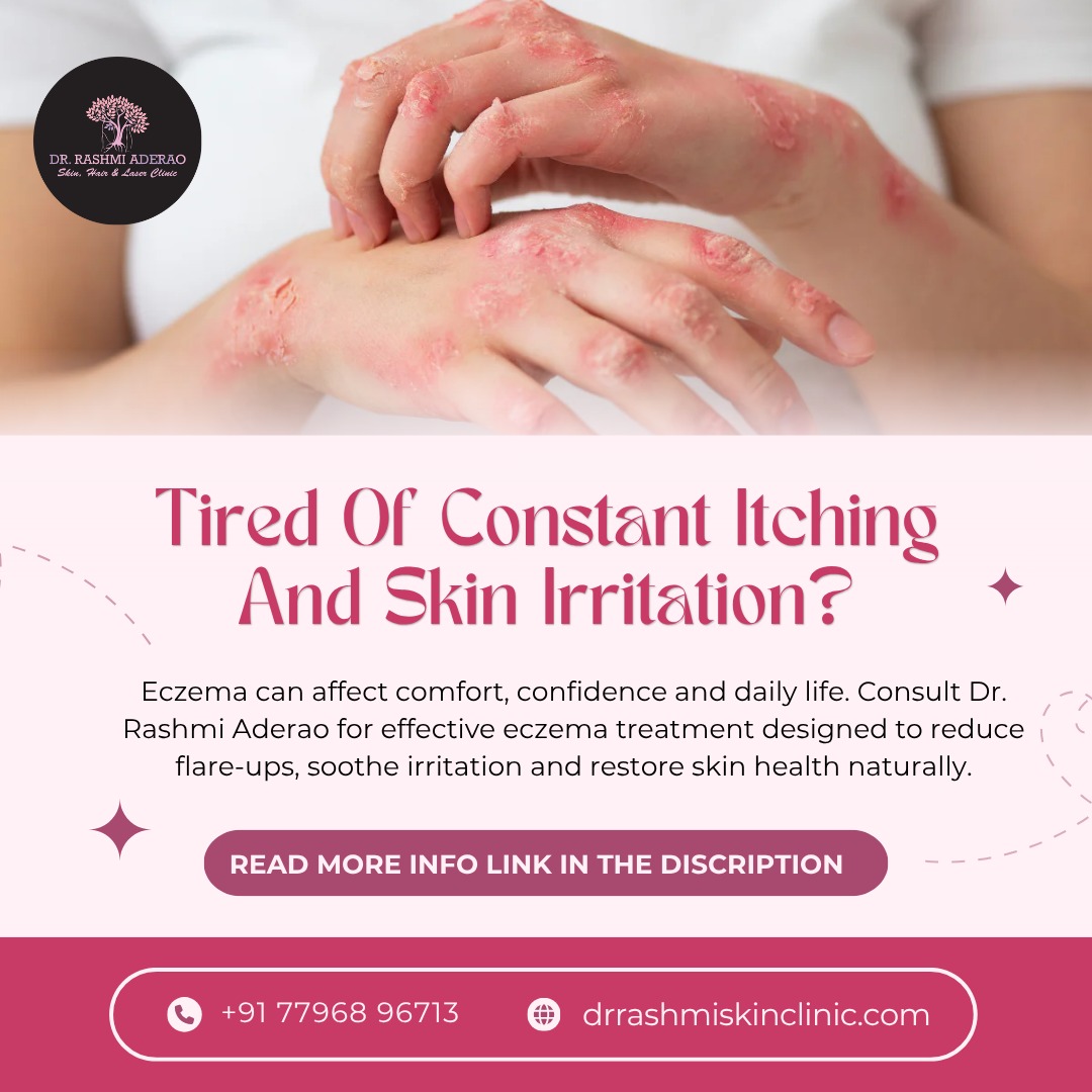 Eczema Treatment in Pune