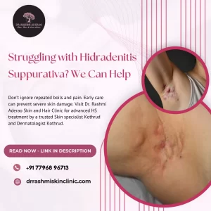 Hidradenitis Suppurativa Treatment in Pune