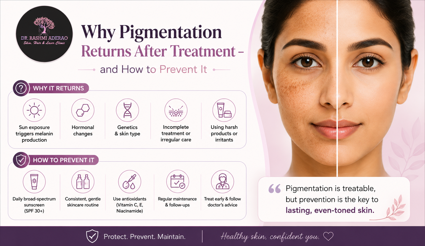 Pigmentation Returns