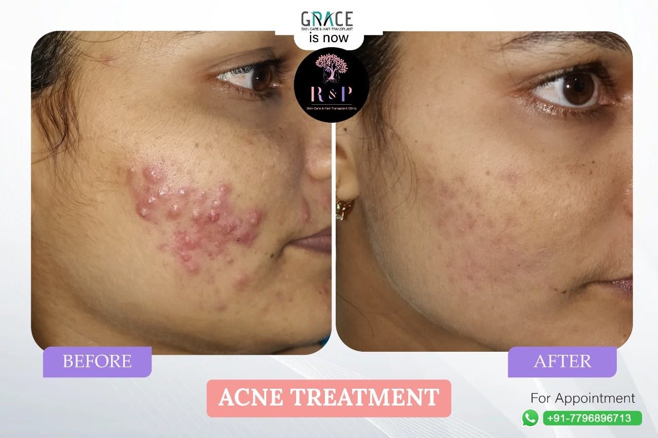 Skin Specialist Kothrud